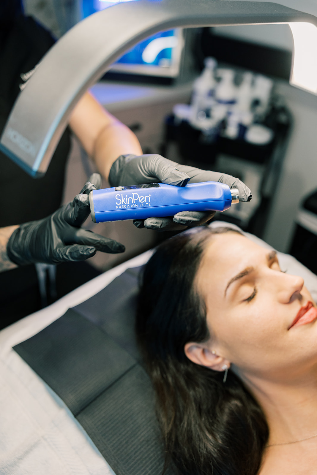 Skinpen Microneedling